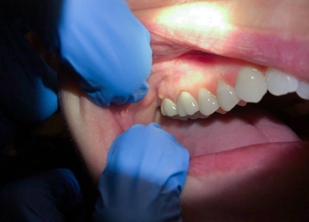 Best Walk-In Emergency Dentist in Sarand, AL